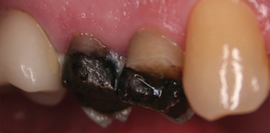 Before - Beechcroft Dental Practice