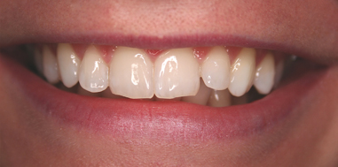 After - Beechcroft Dental Practice