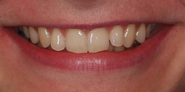 Before - Beechcroft Dental Practice