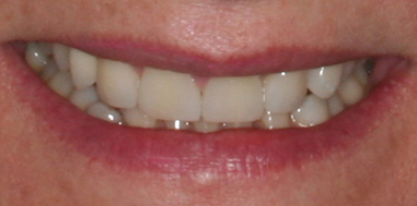 After - Beechcroft Dental Practice