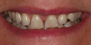 Before - Beechcroft Dental Practice