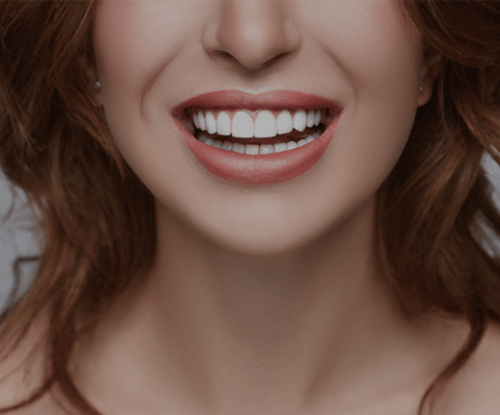 Treatment - Beechcroft Dental Practice